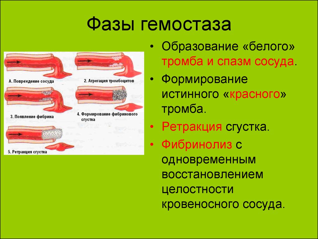 Разрыв кровеносного сосуда. Стадии коагуляционного гемостаза. Основные этапы гемостаза. Фазы вторичного гемостаза. Этапы первичного гемостаза.