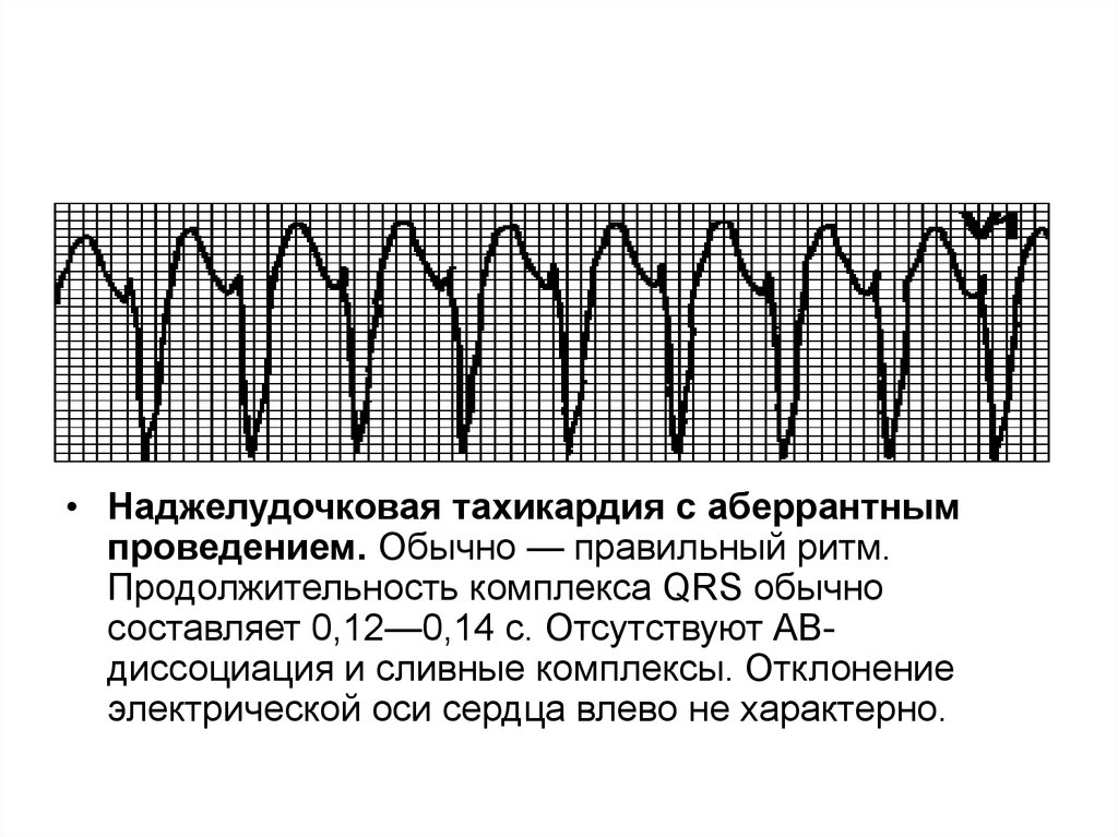 Синусовая тахикардия карта вызова