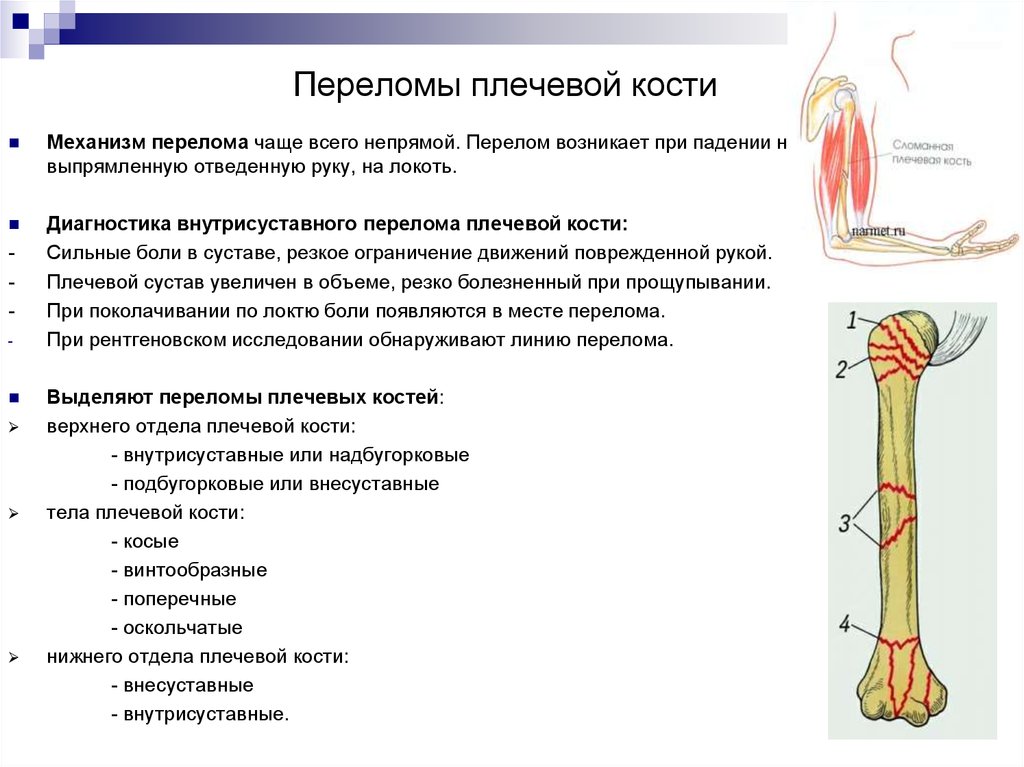 Закрытый перелом плечевой кости. Переломы диафиза плечевой кости симптомы. Механизм перелома диафиза плечевой кости. По локализации перелома плечевой кости. При переломе плеча активные движения в суставе.