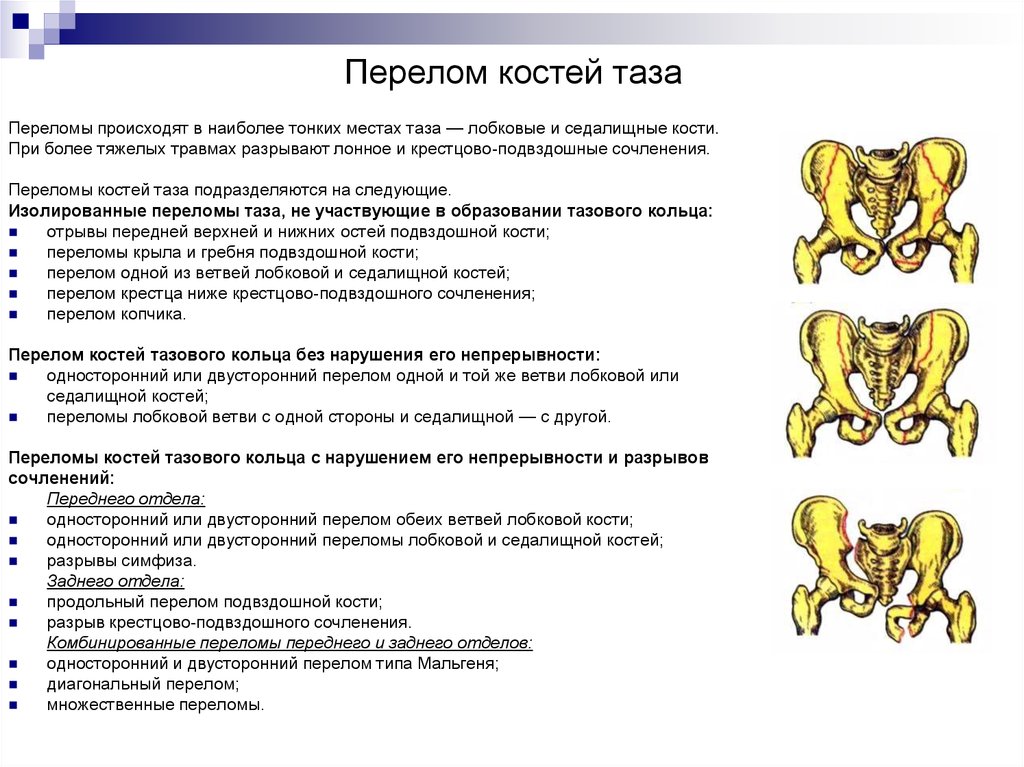 Повреждения таза травматология презентация