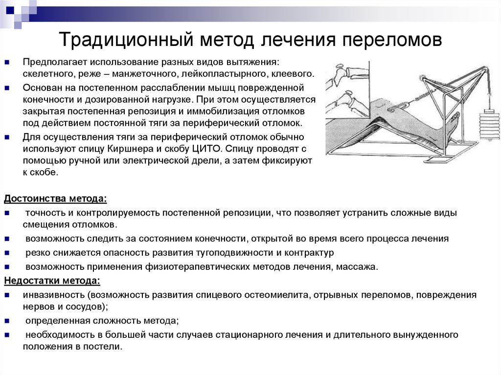 Этапы лечения переломов