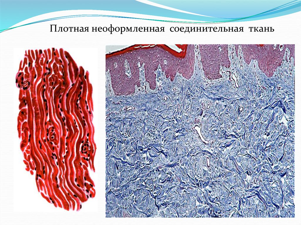 Плотная соединительная ткань. Плотная неоформленная соединительная ткань. Плотная волокнистая неоформленная соединительная ткань. Плотная неоформленная волокнистая соед ткань. Плотная неоформленная соединительная ткань препарат гистология.
