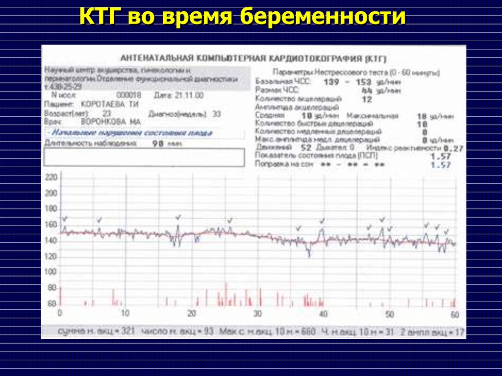 Ктг 38 недель