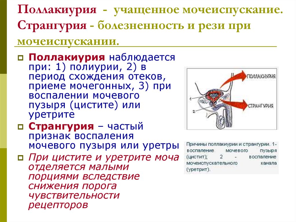 Постоянно мочеиспускание причины. Поллакиурия. Поллакиурия причины. Поллакиурия характерна для. Поллакиурия и странгурия.