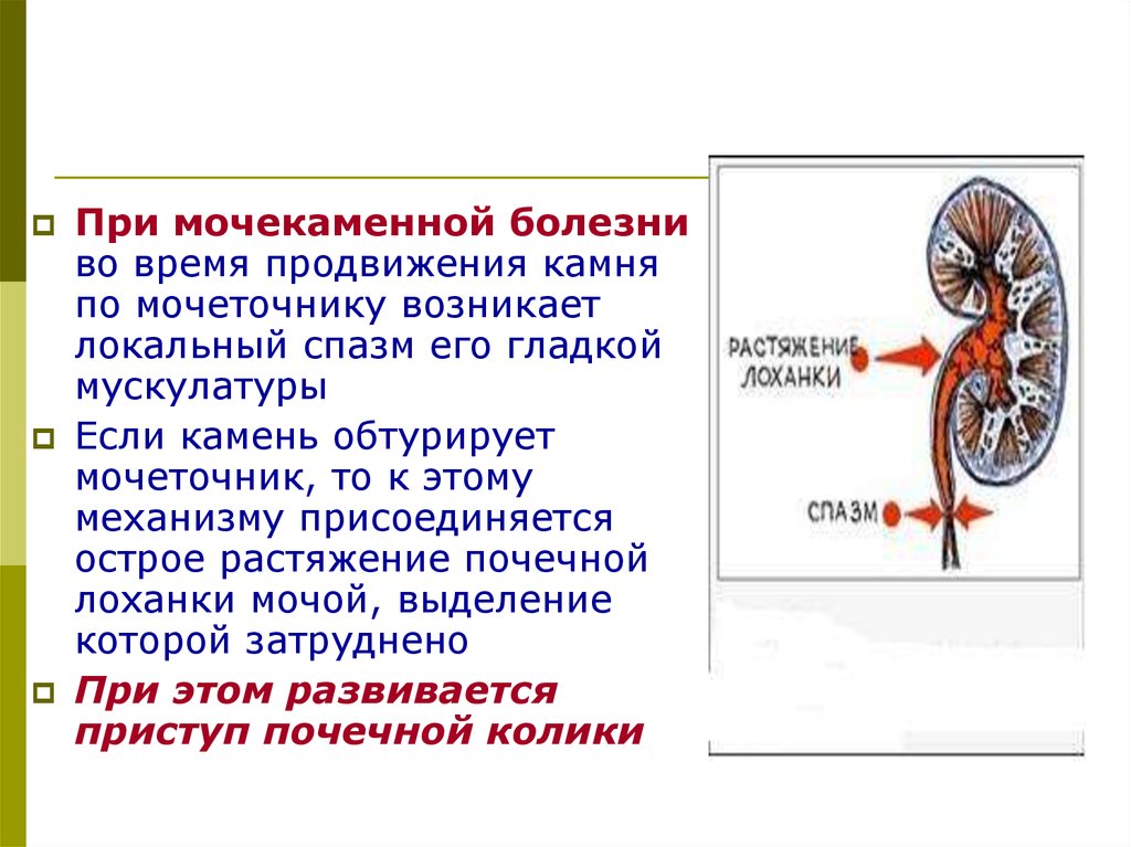 Почечная колика мочекаменная болезнь карта вызова