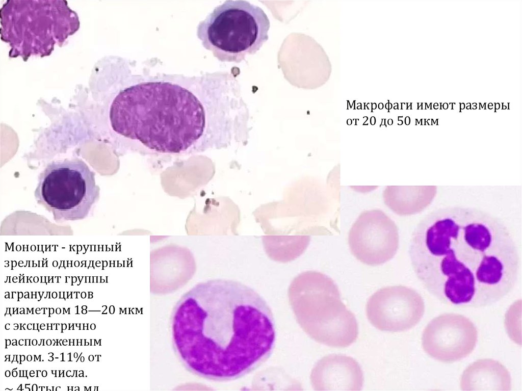Макрофаги 1 3. Макрофаг гистиоцит гистология. Макрофаг гистология препарат. Гистология макрофаги клетки. Лейкоциты, гистиоциты, макрофаги.