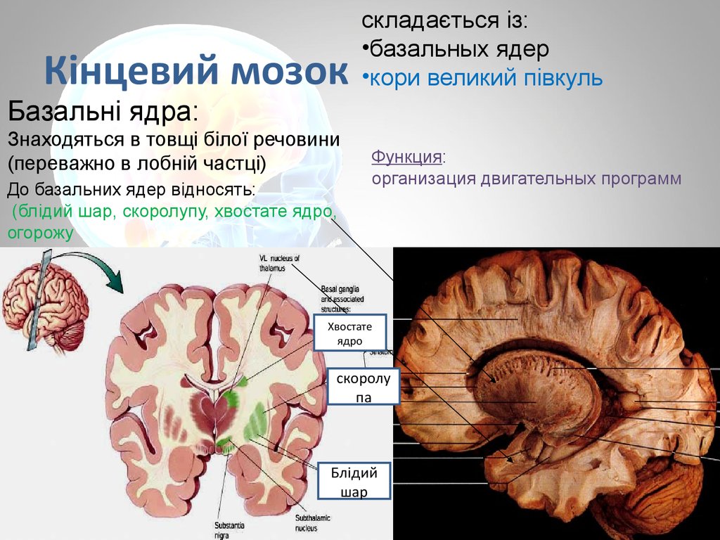 Изменение в базальных отделах. Базальные ядра. Базальные подкорковые ядра. Базальные ядра головного мозга. Базальные (подкорковые) ядра конечного мозга.