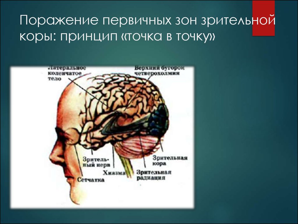 Слуховая зона коры находится в