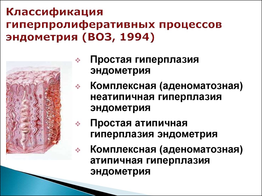 Гиперплазия эндометрия лечение. Атипичная аденоматозная гиперплазия легкого. Классификация гиперпластических процессов эндометрия воз 1994. Гиперпластические процессы эндометрия классификация. Классификация гиперпластических процессов эндометрия воз.