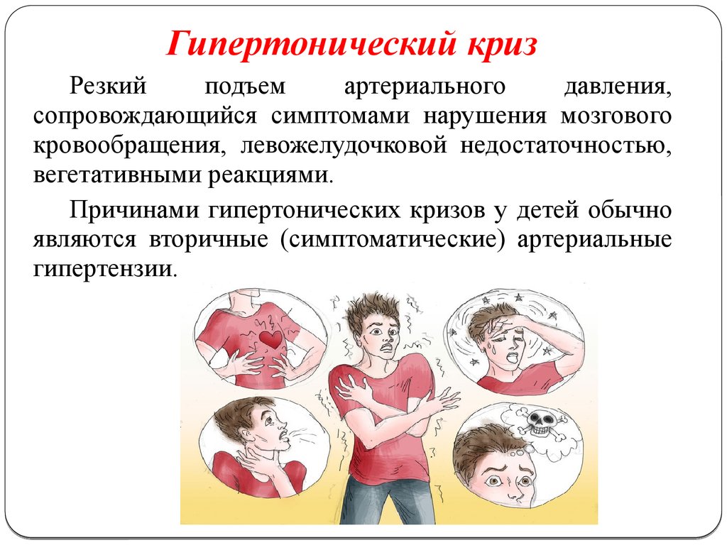 Гипертонический криз презентация