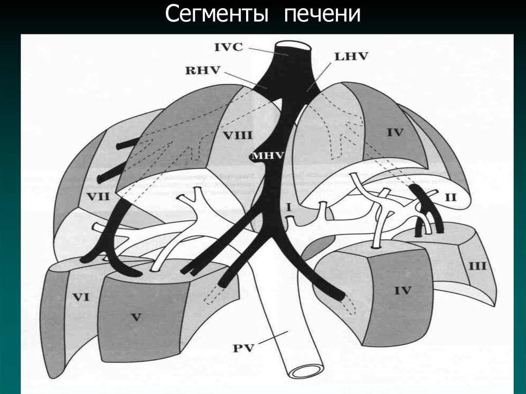 И нелепая схема замоскворечья на печени