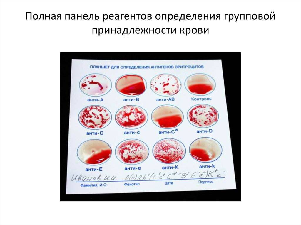 Группы крови стандартными эритроцитами