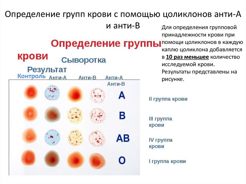 Резус фактор крови цоликлонами