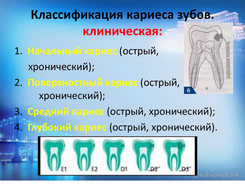 Кариес определение этиология классификация стадии макроскопическая картина осложнения и исходы