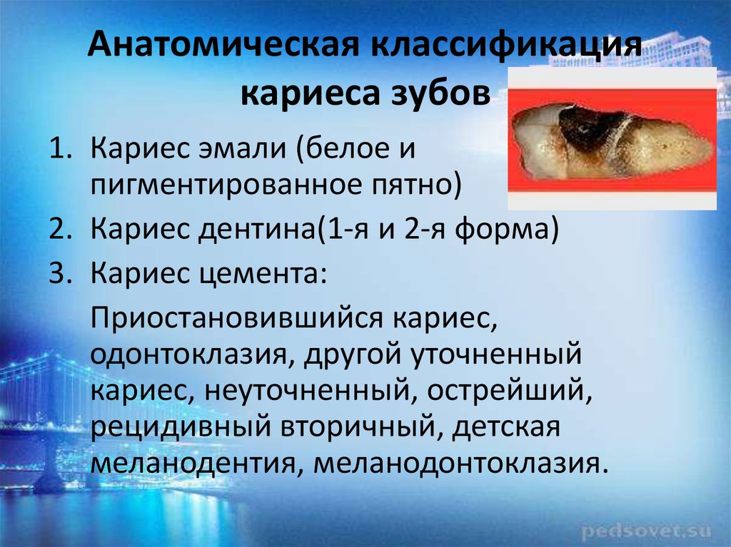 Классификация кариеса презентация