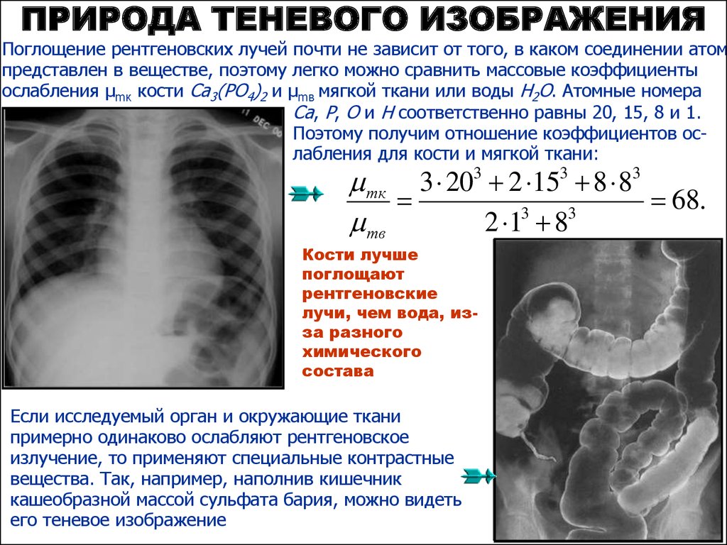 Рентгеновское изображение получается в результате