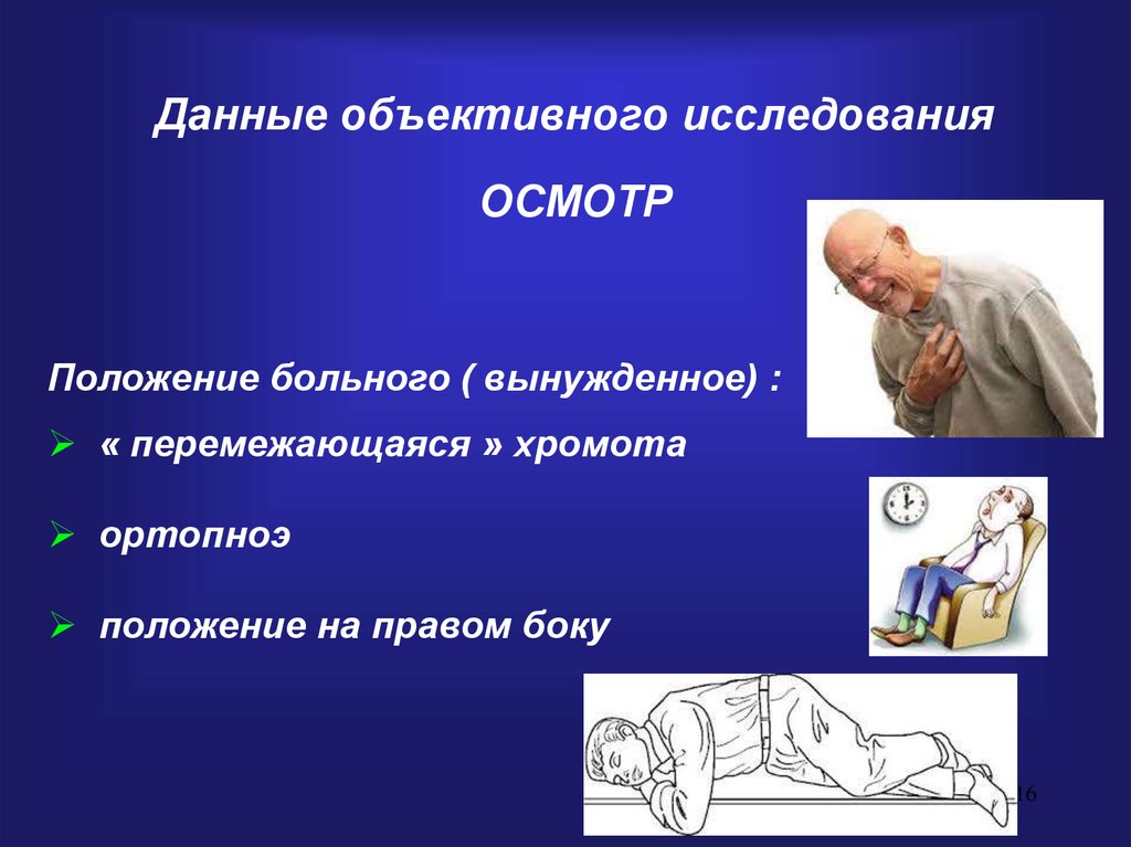 Ортопноэ. Ортопноэ положение пациента. Положение ортопноэ характерно для. Вынужденное положение «ортопноэ» характерно для.