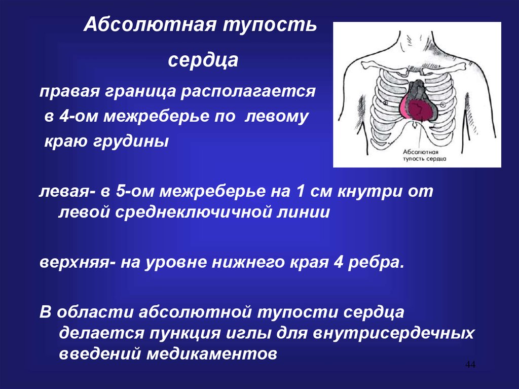 Границы сердца. Границы абсолютной тупости сердца. Перкуссия абсолютной тупости сердца. Границы абсолютной сердечной тупости в норме. Определение границ абсолютной сердечной тупости.