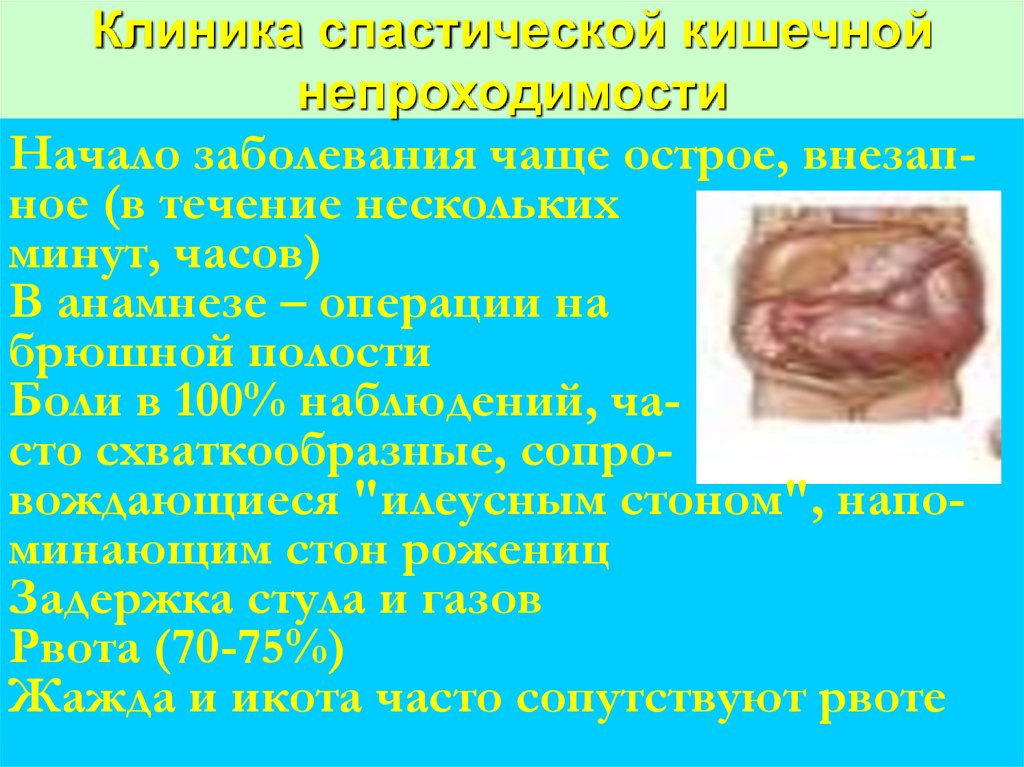Клиника спастической кишечной непроходимости