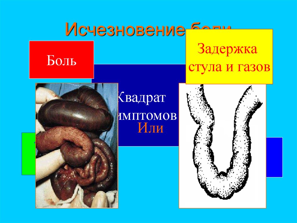 Исчезновение боли