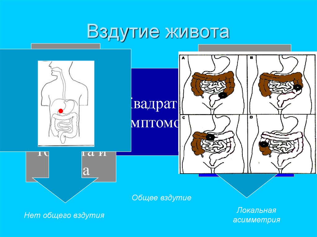 Вздутие живота 18. Вздулся желудок и тошнит.