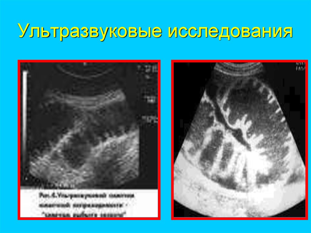 Ультразвуковые исследования