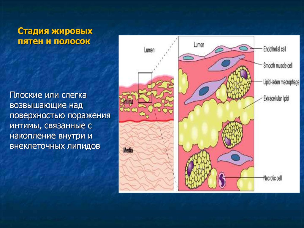Стадия жировых пятен и полосок