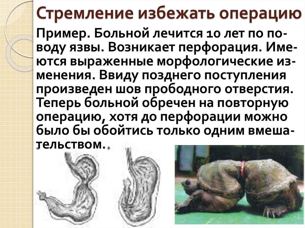 Стремление избежать операцию