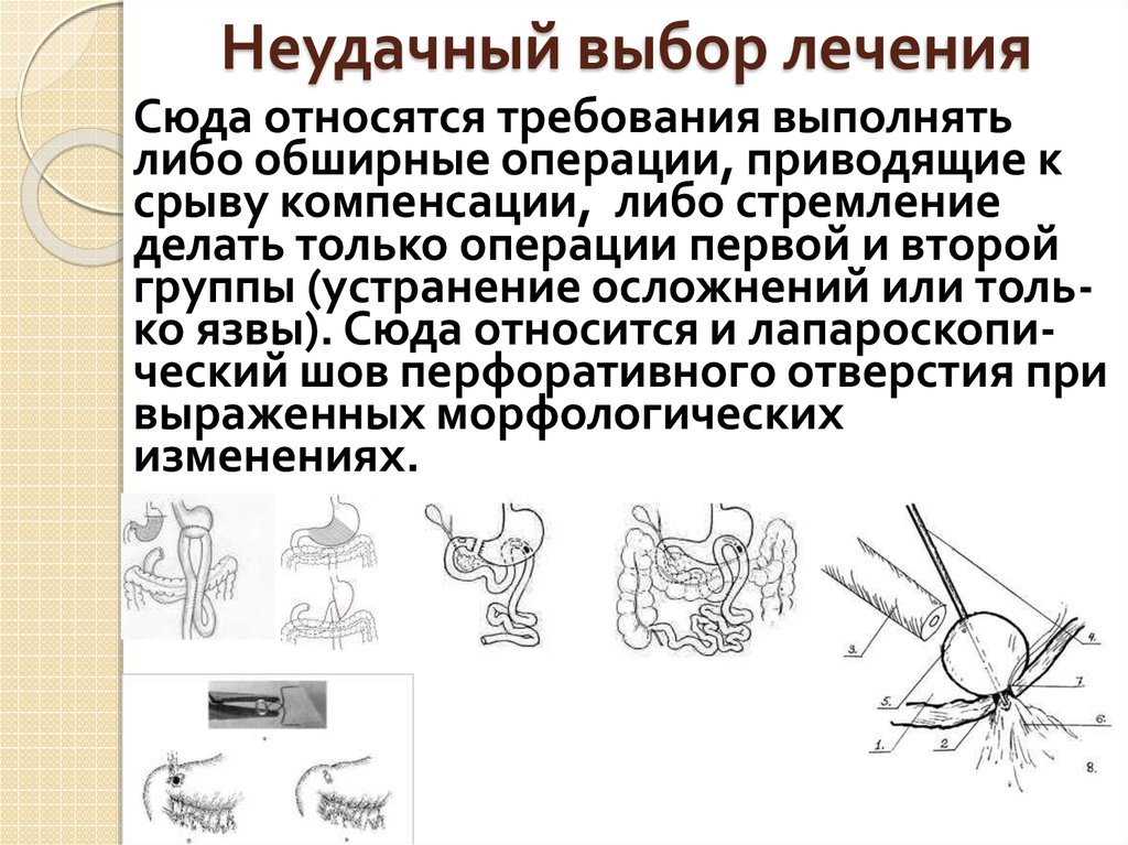 Неудачный выбор лечения