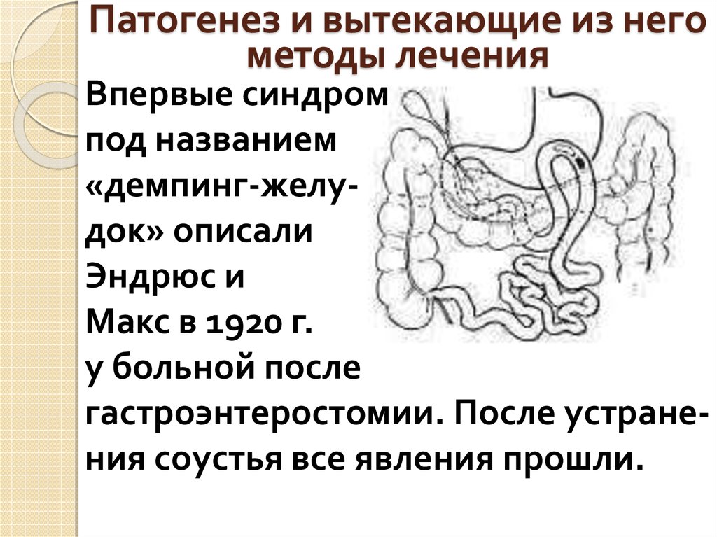 Демпинг синдром после