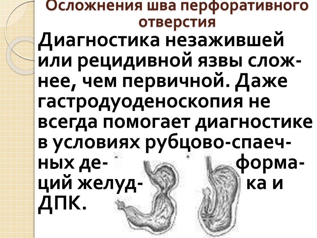 Осложнения шва перфоративного отверстия