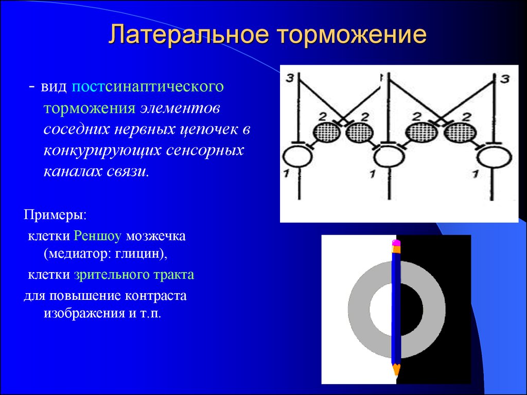 Латеральное торможение схема