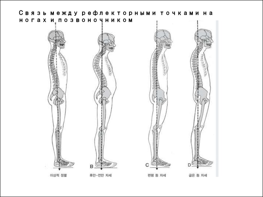 Связь позвоночника с конечностями человека. Искривление позвоночника скелет. Постуральный сколиоз. Сколиоз позвоночника анатомия. Правильная осанка скелет.