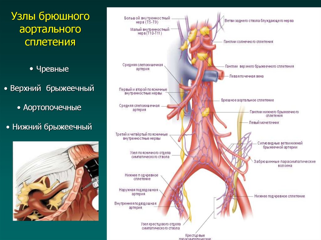 Нервные узлы и нервные стволы. Узлы чревного сплетения. Чревные узлы анатомия. Вегетативные сплетения брюшной полости. Топография чревного сплетения.