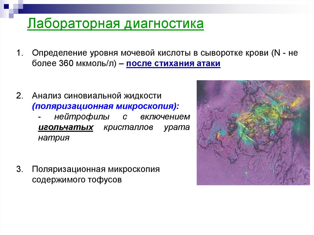 Подагра биохимия презентация