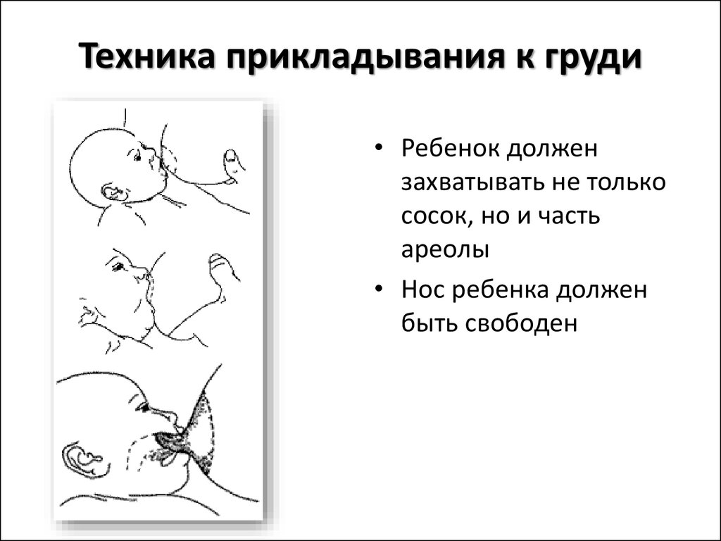 Правильное грудное. Техника прикладывания при грудном вскармливании. Правила прикладывания новорожденного к груди для кормления.. Правильное прикладывание малыша к груди. Как правильно прикладывать ребенка для кормления новорожденного.