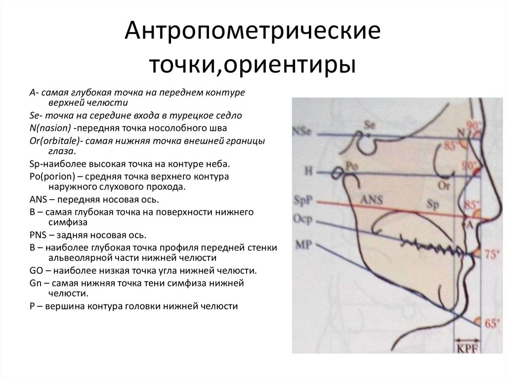 Линия нс. Антропометрические точки ортодонтия. Антропометрические методы исследования в стоматологии. ТРГ точки. Антропометрические ориентиры.