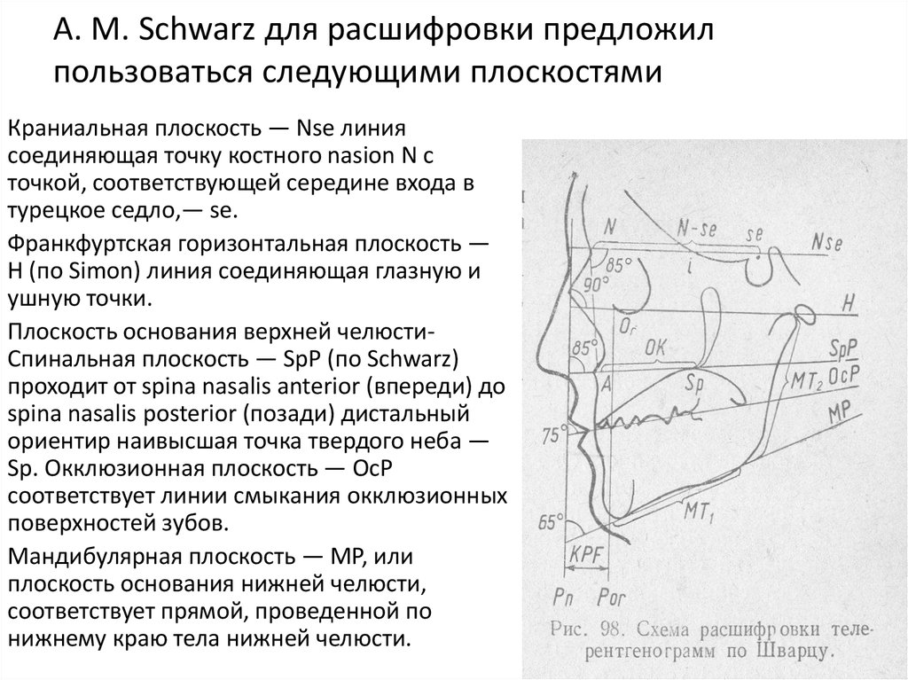 Угол spp mp. Франкфуртская плоскость в стоматологии. Камперовская плоскость и франкфуртская горизонталь. Горизонтали в стоматологии. Франкфуртская горизонталь точки.