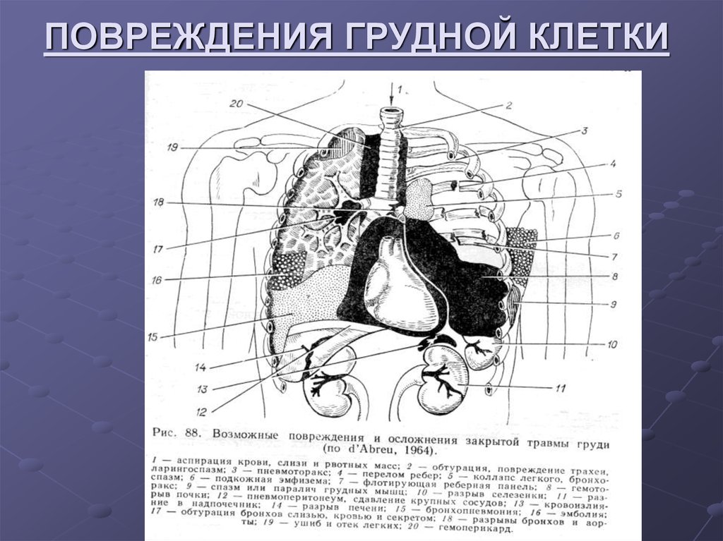 Травмы грудной клетки