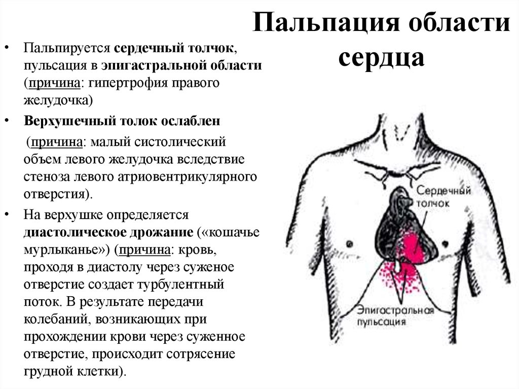 Почему болит сердце. Пальпация и перкуссия области сердца. Пальпация области сердца пропедевтика. Пульсация в области груди.