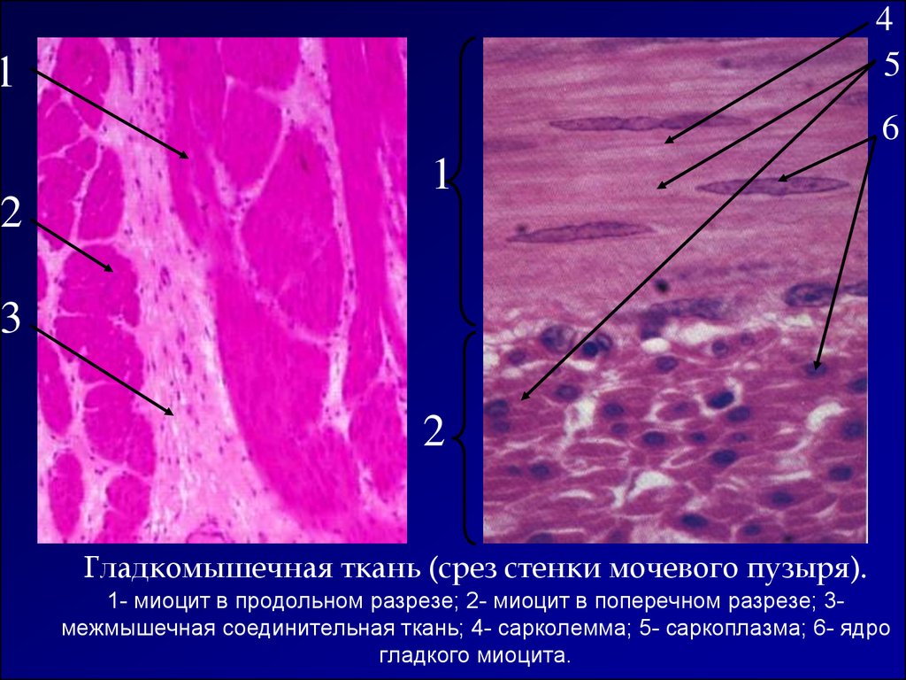Ткани стенкам. Гладкая мышечная ткань мочевого пузыря гистология. Гладкая мышечная ткань срез мочевого пузыря препарат. Гладкая мышечная ткань срез матки. Гладкомышечная ткань препарат гистология.