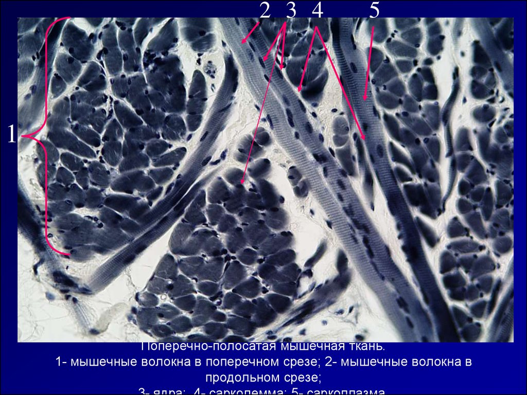 Полосатая мышца. Поперечнополосатая Скелетная мышечная ткань препарат. Симпласт поперечно полосатая мышечная ткань препарат. Поперечнополосатая мышечная ткань языка препарат гистология. Скелетная поперечно полосатая мышечная ткань гистология препарат.