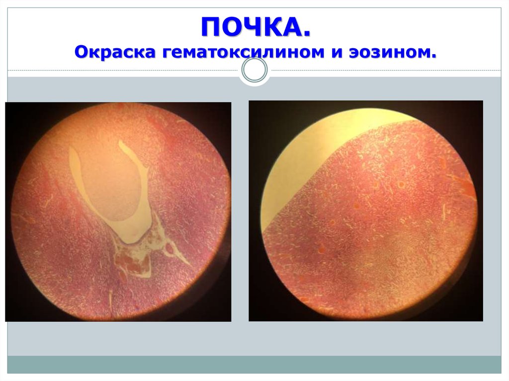 Увеличенная малая. Препарат почки гематоксилин э. Почка окраска гематоксилин-эозином. Препарат - почка. Окраска гематоксилин-эозином.. Почка», окрашенный гематоксилином и эозином.