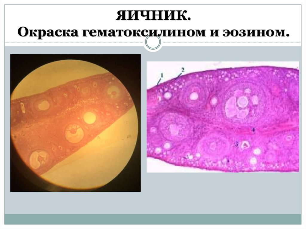 Яичник у млекопитающих. Препарат - яичник. Окраска гематоксилин-эозином.. Яичник окраска гематоксилином и эозином. Яичник млекопитающего окраска гематоксилином и эозином.