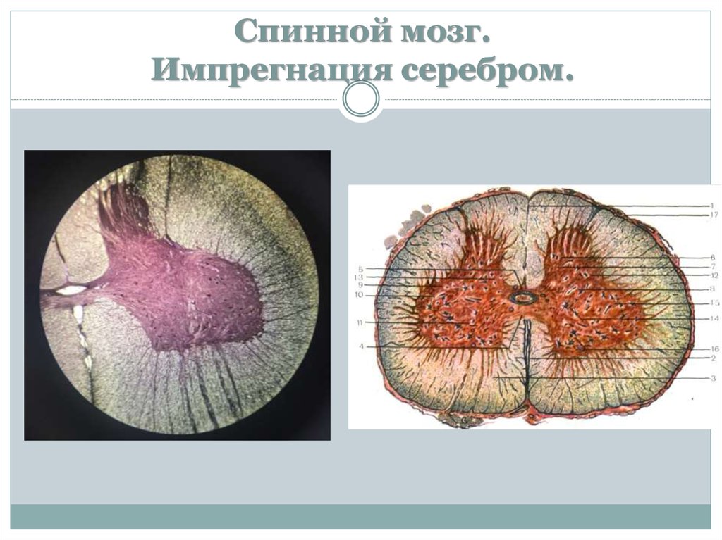 Ткань мозжечка. Мозжечок гистология. Клетки спинного мозга гистология. Спинной мозг гистология препарат. Спинной мозг гистология окраска.