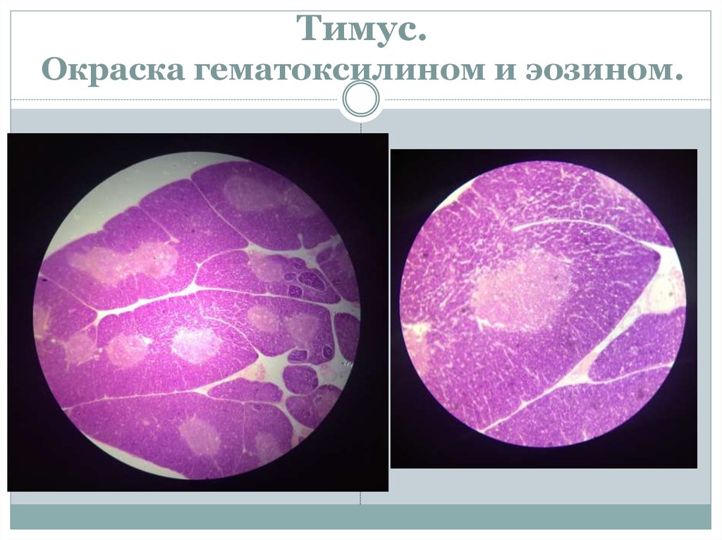 Тимус гематоксилин эозин рисунок