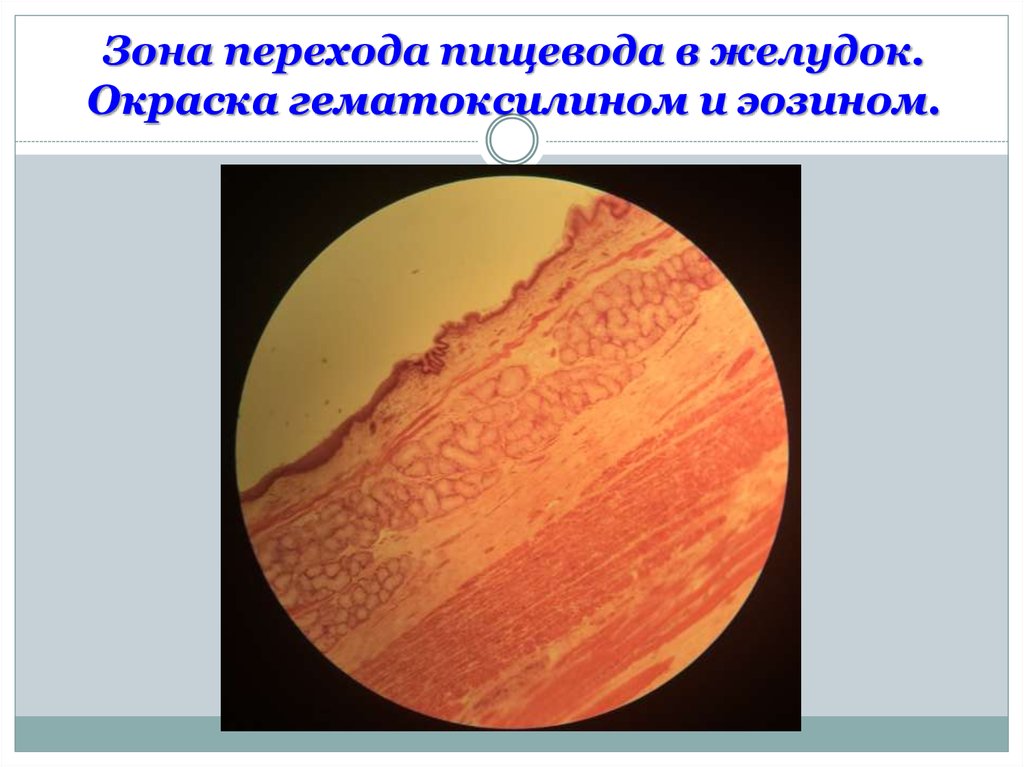 Переход пищевода в желудок гистология. Переход пищевода в желудок окраска гематоксилин-эозин. Переход пищевода в желудок препарат гистология. Место перехода пищевода в желудок гистология. Пищевод окраска гематоксилин-эозином.