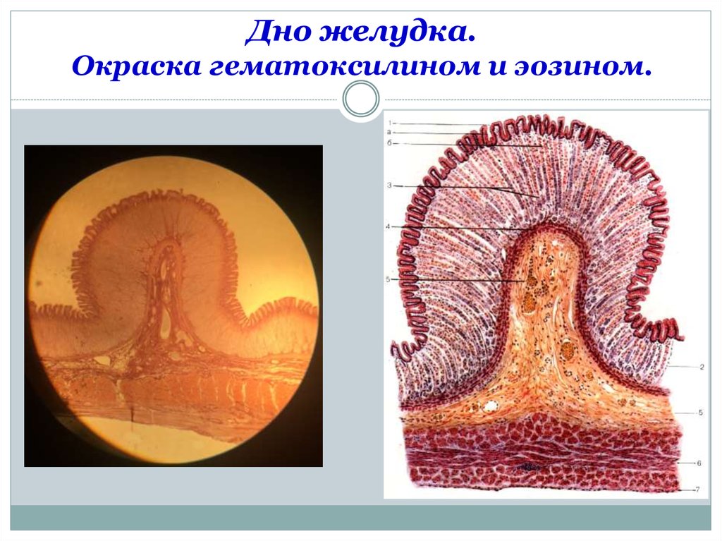 Дно желудка гистология рисунок