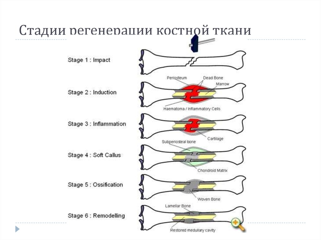 Сроки заживления кости