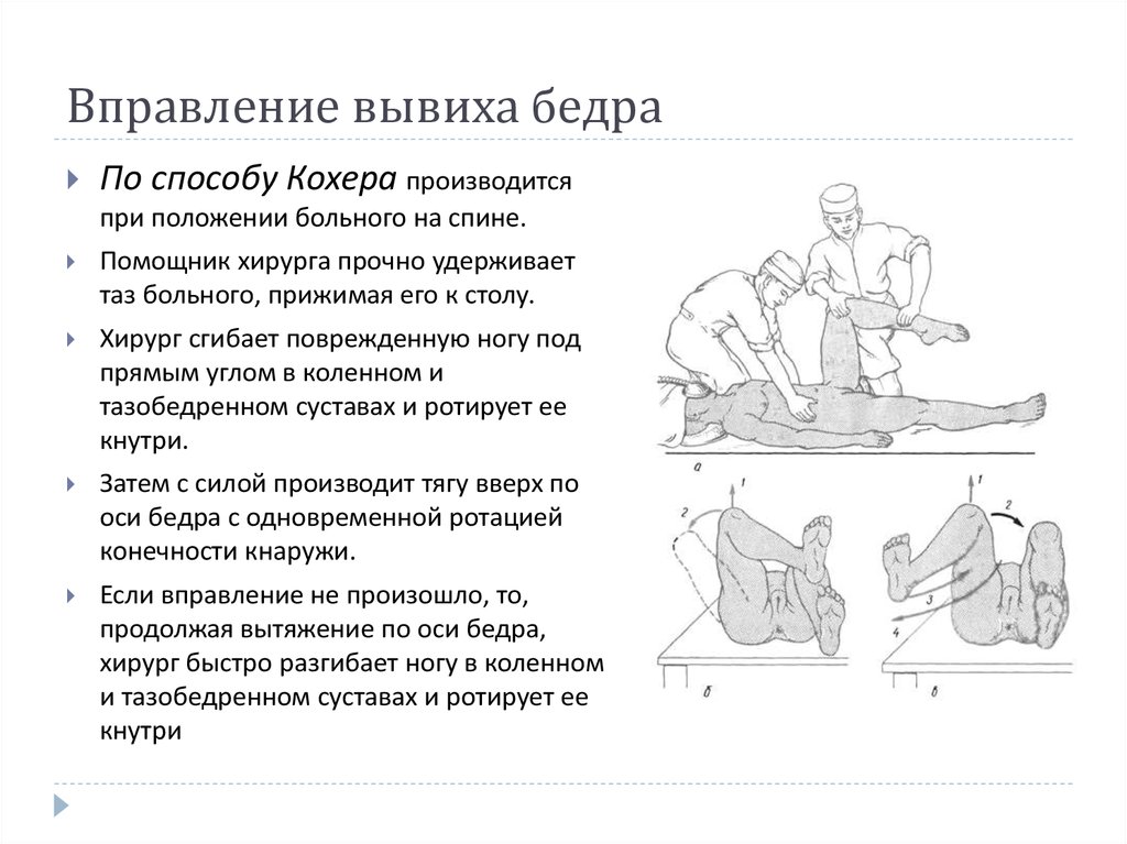 Почему нельзя самому вправлять сустав при вывихе. Вправление вывиха бедра методом кохера. Методы вправления вывиха бедра. Вправление бедра по методу кохера. Методика вправления вывиха тазобедренного сустава.